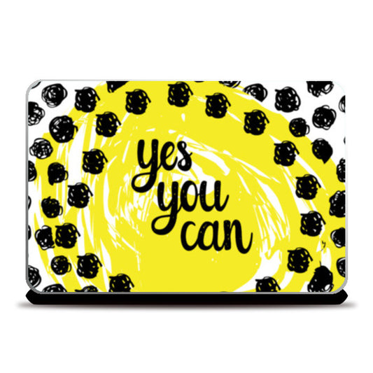 Laptop Skins, YES YOU CAN! Laptop Skins